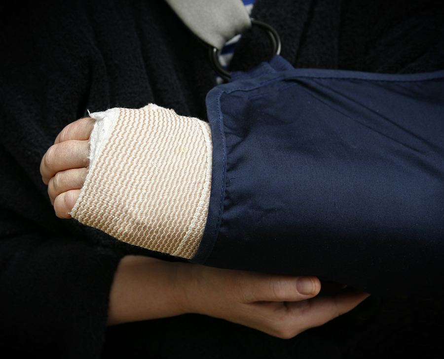 Call 317-881-2700 to File a Broken Bone Injury Claim in Indiana